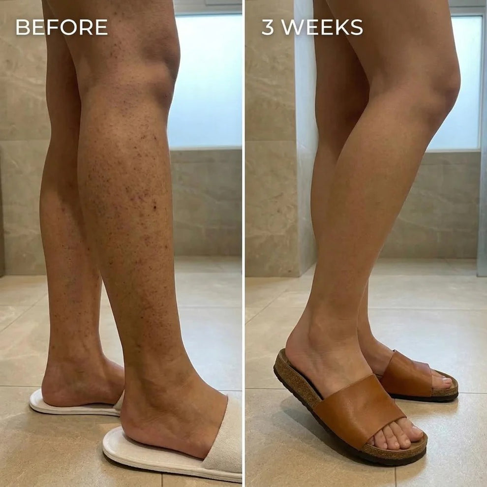 Cyperus Rotundus Skin Serum - Stop Unwanted Hair Growth Naturally - 100% Real [Buy 1 Get 1 Free]